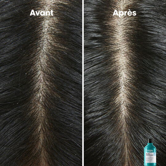 Shampooing dermo-clarifiant anti-pelliculaire Scalp Advanced 300ml