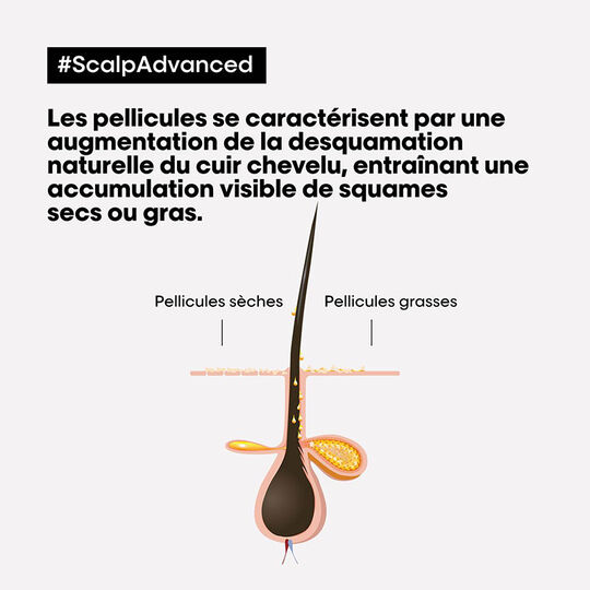Routine anti-pellicules grasses Scalp Advanced