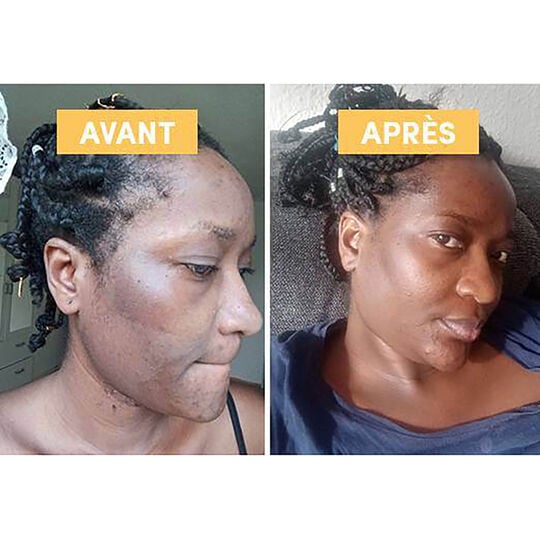 Mac&eacute;rat huileux de busserole