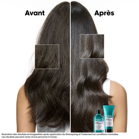 Shampooing dermo-r&eacute;gulateur anti-inconfort Scalp Advanced 500ml