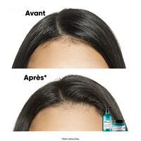 Shampooing dermo-purifiant anti-gras Scalp Advanced 500ml