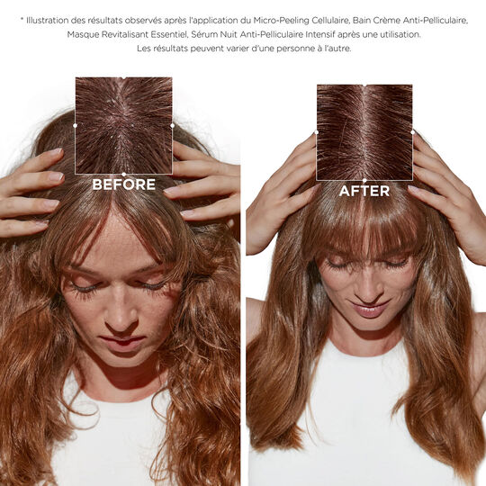 Bain crème anti-pelliculaire Symbiose