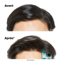 Shampooing dermo-purifiant anti-gras Scalp Advanced 500ml