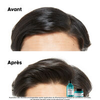 Shampooing dermo-purifiant anti-gras Scalp Advanced 300ml